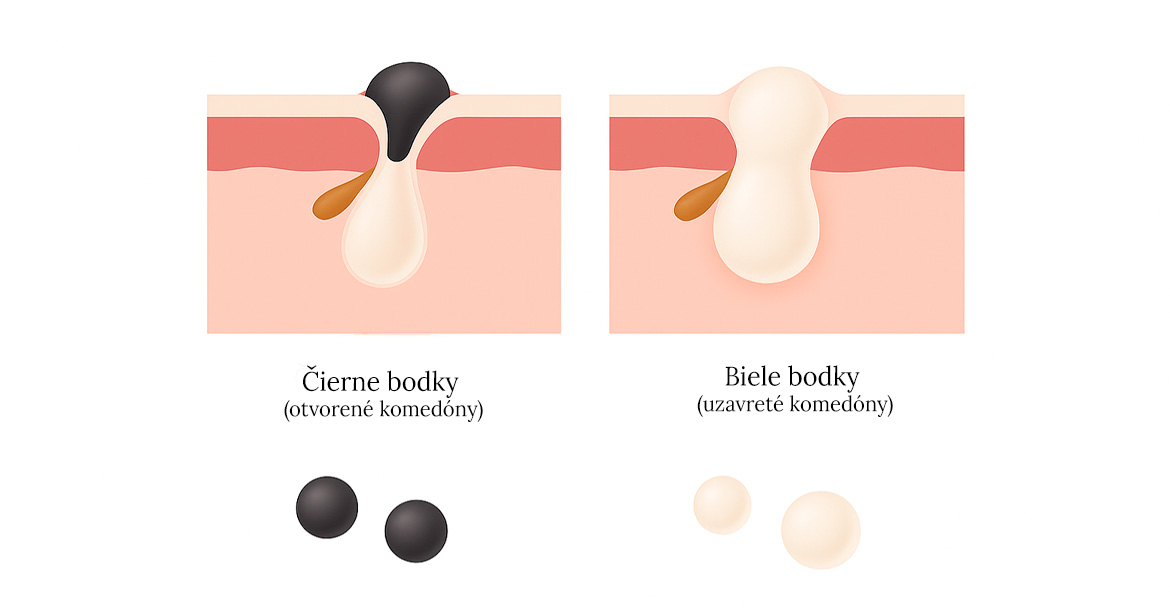 SK_1170x_cerne_bile_tecky